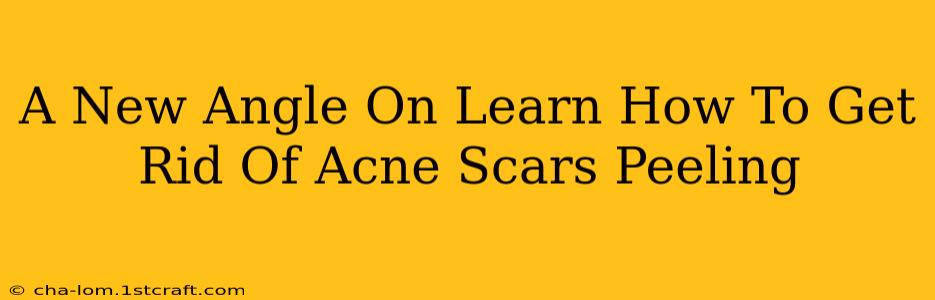 A New Angle On Learn How To Get Rid Of Acne Scars Peeling