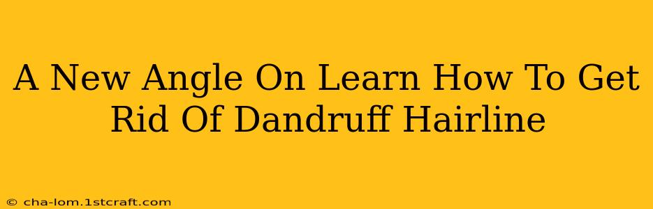 A New Angle On Learn How To Get Rid Of Dandruff Hairline