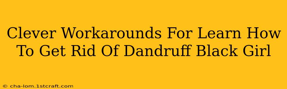 Clever Workarounds For Learn How To Get Rid Of Dandruff Black Girl