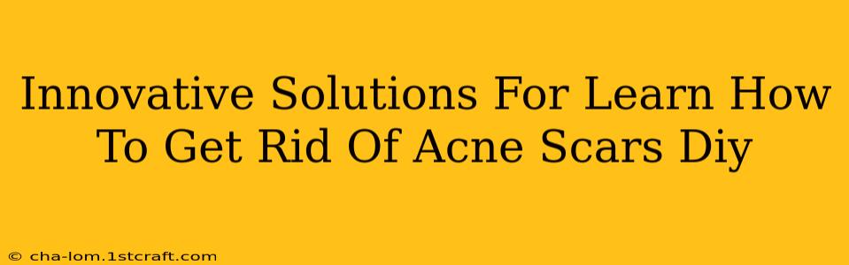 Innovative Solutions For Learn How To Get Rid Of Acne Scars Diy