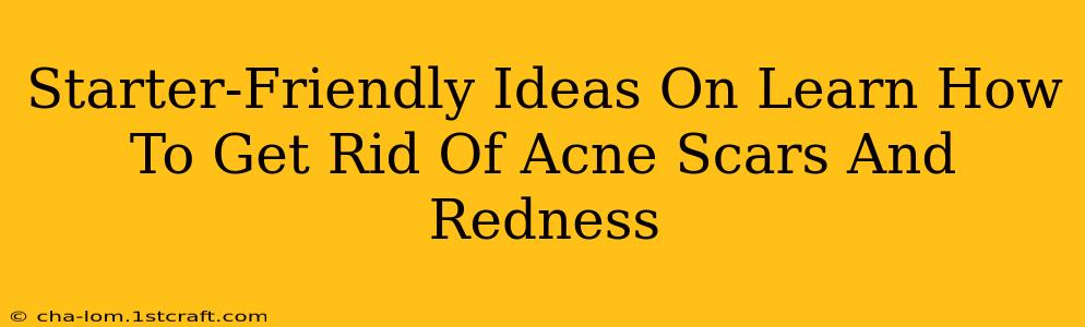 Starter-Friendly Ideas On Learn How To Get Rid Of Acne Scars And Redness