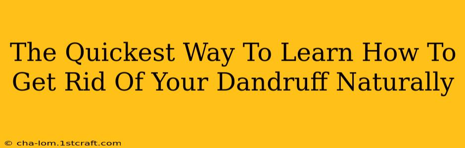 The Quickest Way To Learn How To Get Rid Of Your Dandruff Naturally