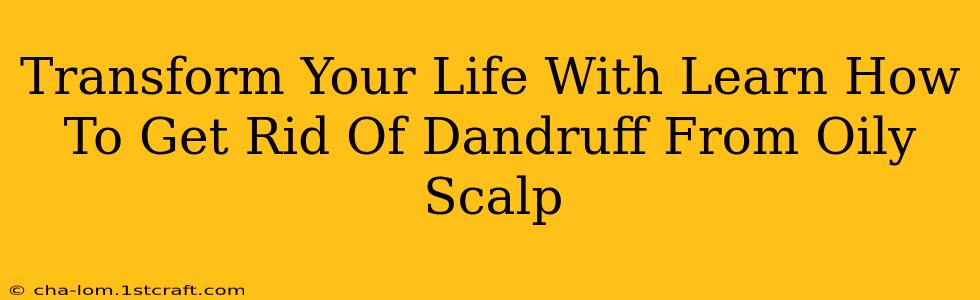 Transform Your Life With Learn How To Get Rid Of Dandruff From Oily Scalp