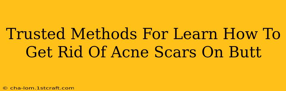 Trusted Methods For Learn How To Get Rid Of Acne Scars On Butt